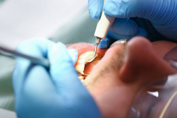 Best Knocked-Out Tooth Emergency  in Green Forest, AR