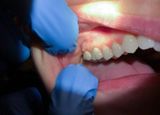 Best Emergency Gum Pain Relief  in Green Forest, AR